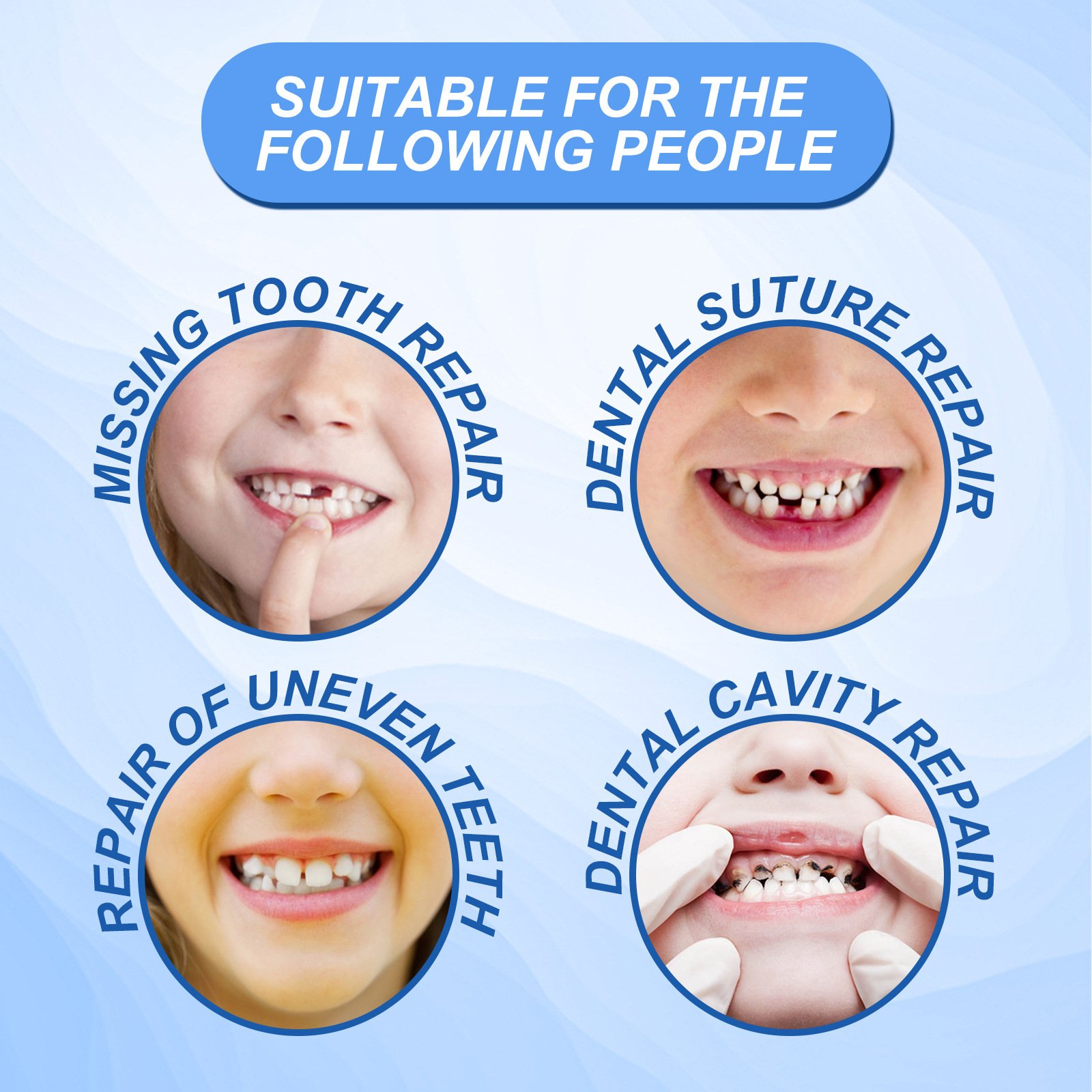 South Moon Solid Dental Gel Fixing Teeth Temporary Filling Cavities Filling Gel Dentures Denture Gap Filling Gel - Image 3