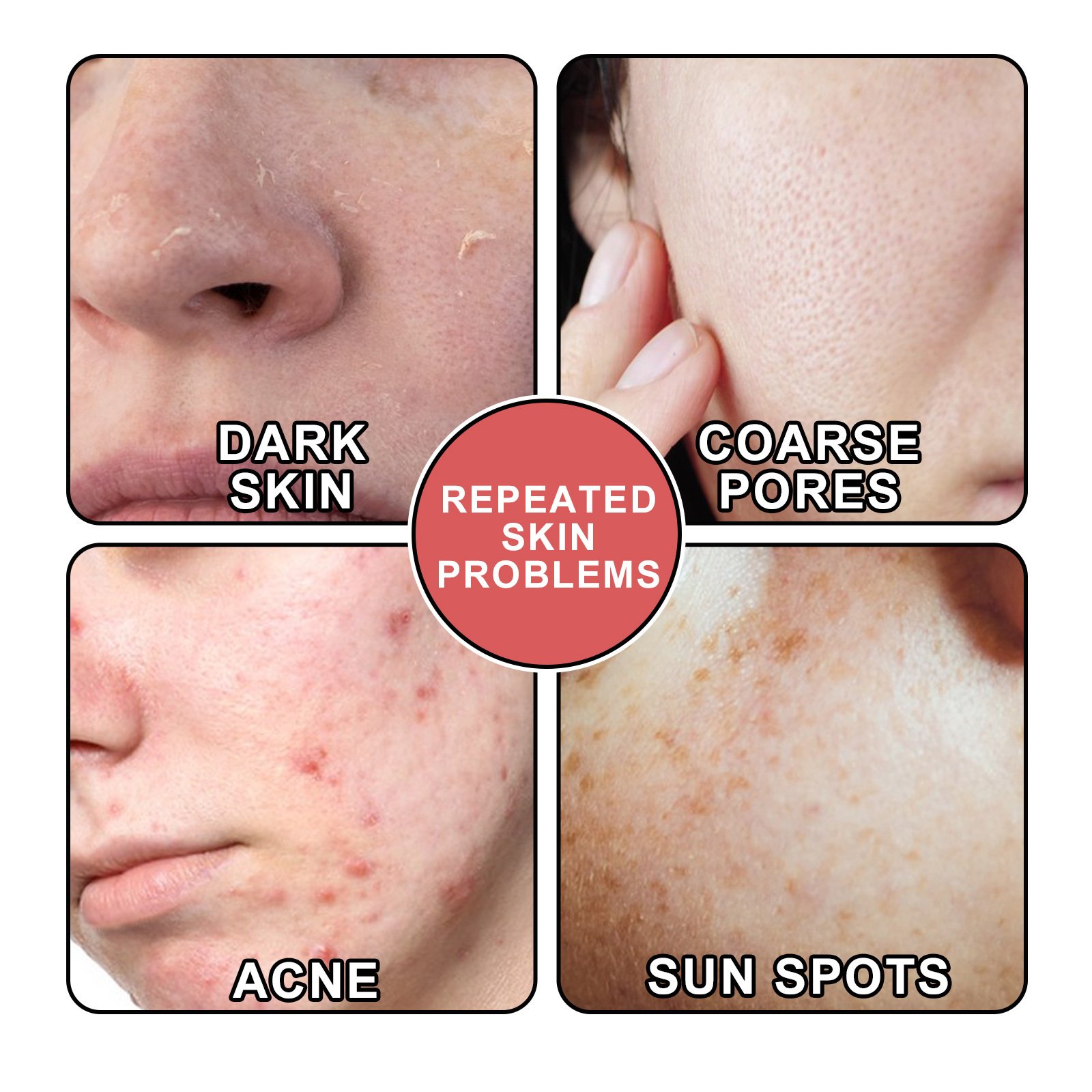 South Moon Nicotinamide Skin Care Essence Facial Skin Hydrating And Firming Skin Care Essence - Image 4