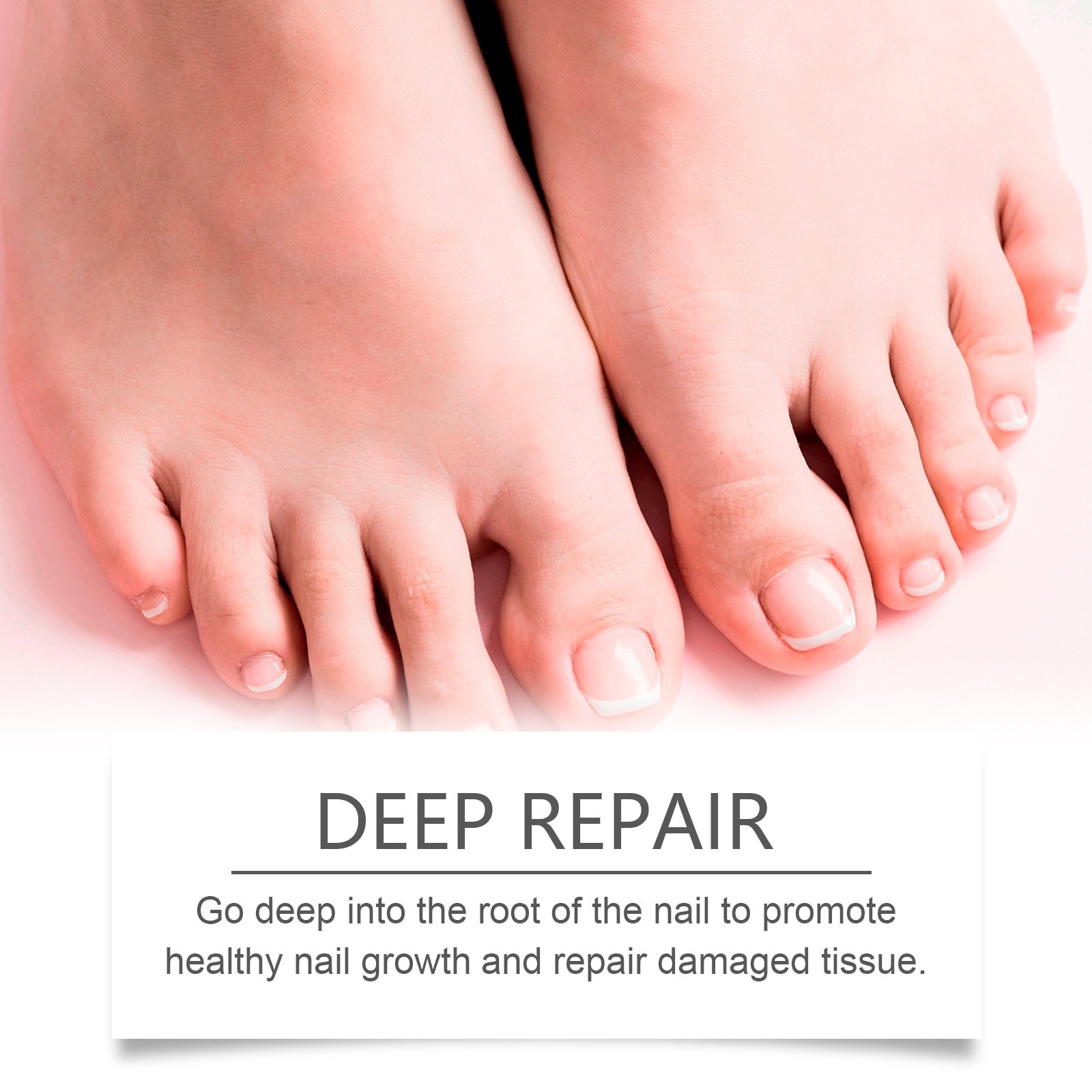 South Moon Nail Repair Solution Soft Nails Thick Nails Cleaning Care Nourishing Care Around The Nail - Image 5